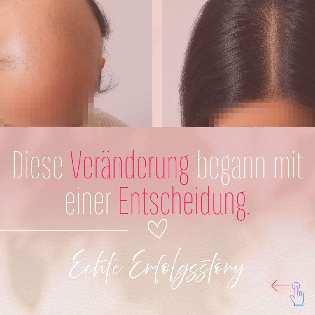 Kaya Veda - Ayurveda Institut Facebook ad: Hinter jedem Vorher-Nachher-Bild steckt eine Geschichte.
