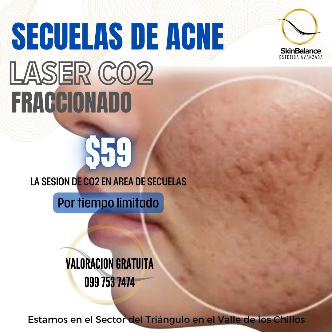 SkinBalance Facebook ad: Evaluación Gratuita