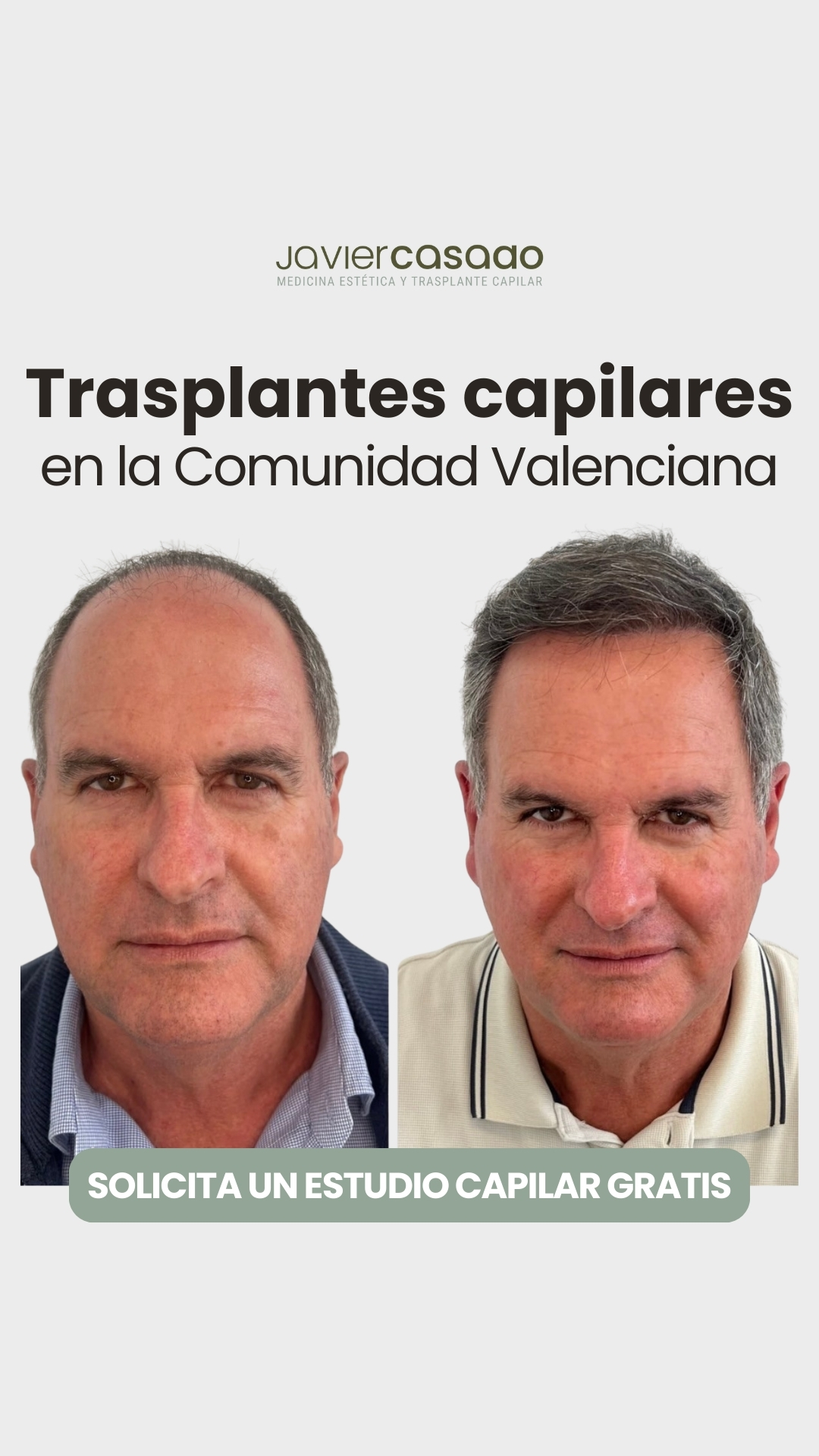 Dr. Javier Casado Facebook ad from Feb 4, 2026