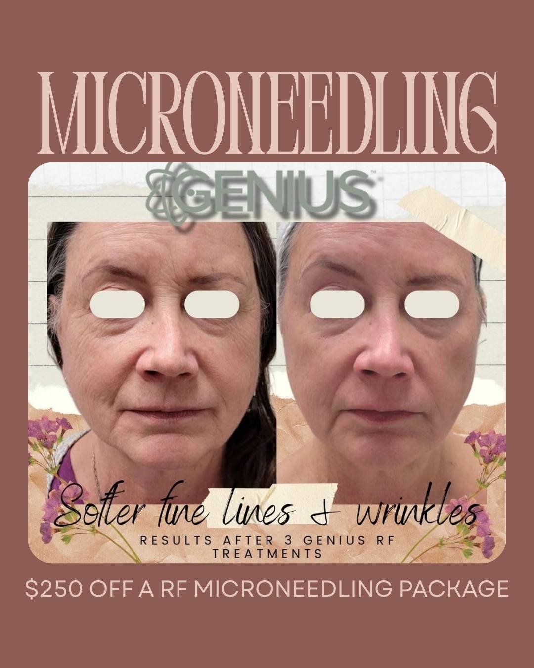 Fountain of Youth Skin Renewal Centre Facebook ad