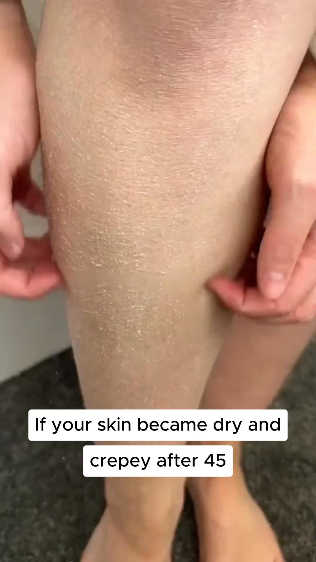 Beauty From Bees Facebook ad: The reason your skin turned crepey.