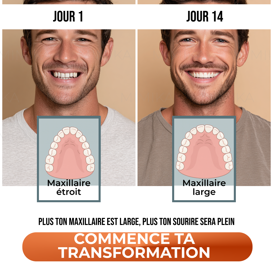 Mark Mewing Facebook ad