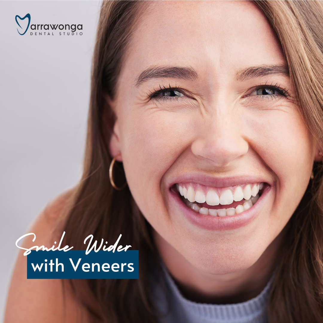 Yarrawonga Dental Studio Facebook ad