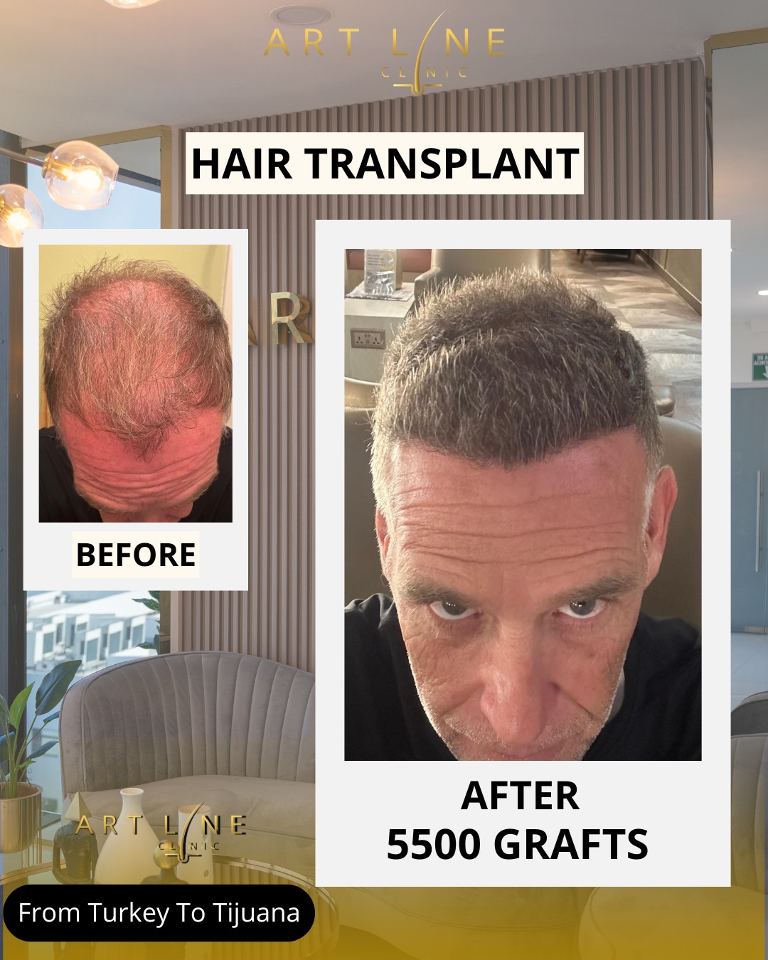Art Line Hair Clinic Facebook ad: Chatea con nosotros