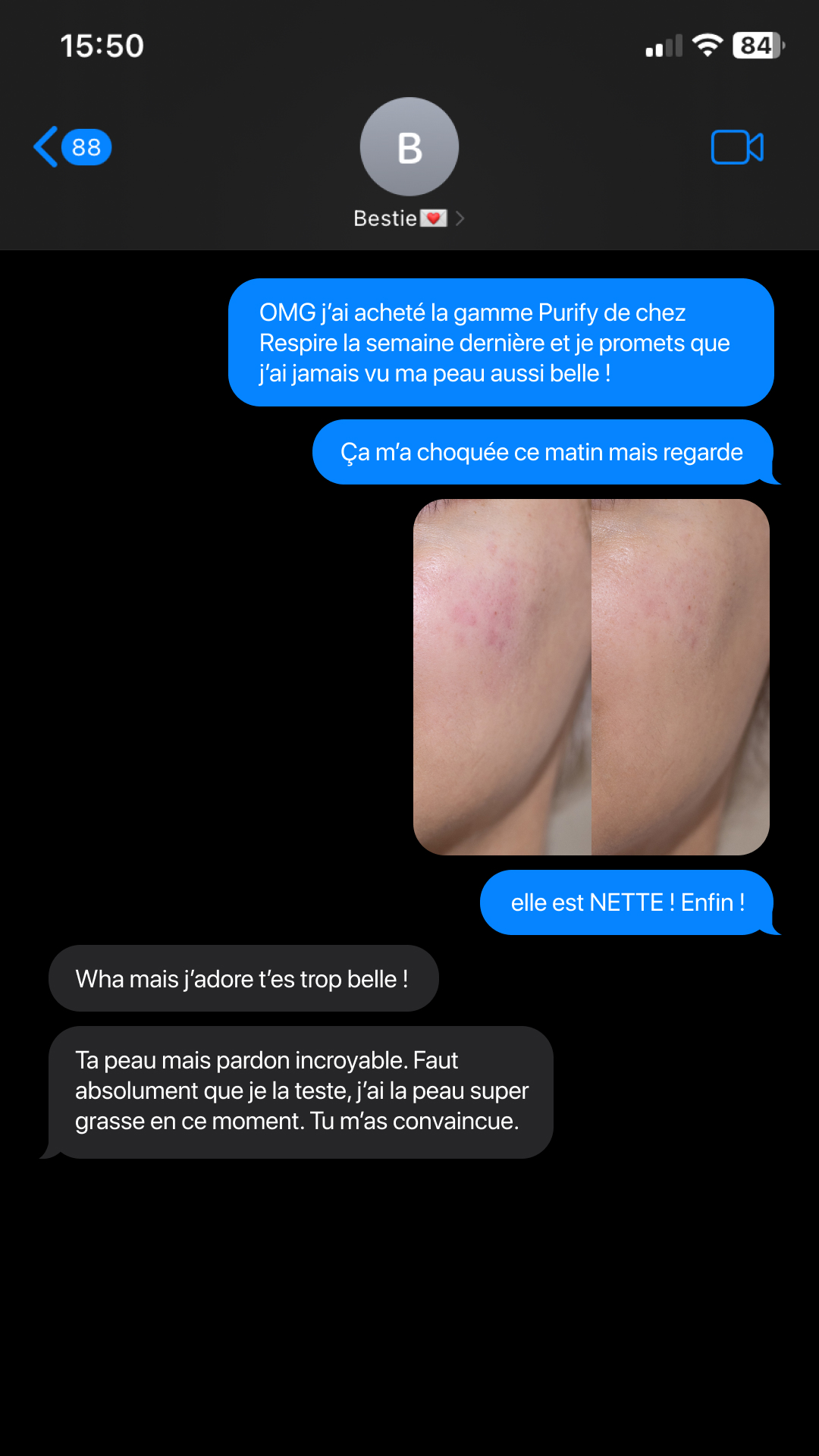 Respire Facebook ad