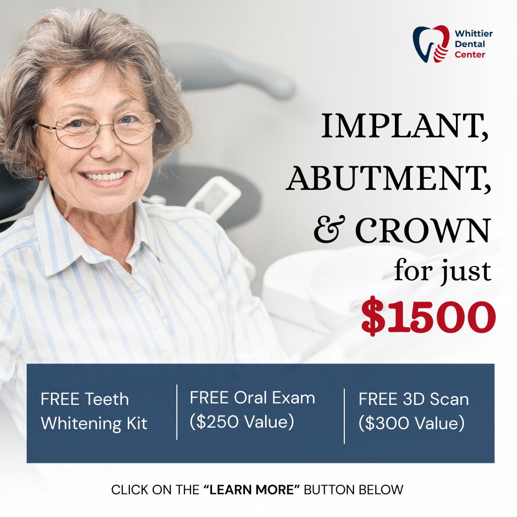Whittier Dental Center & Orthodontics Facebook ad: Hey Los Angeles -New Year Hottest Deal: Implant, Abutment…
