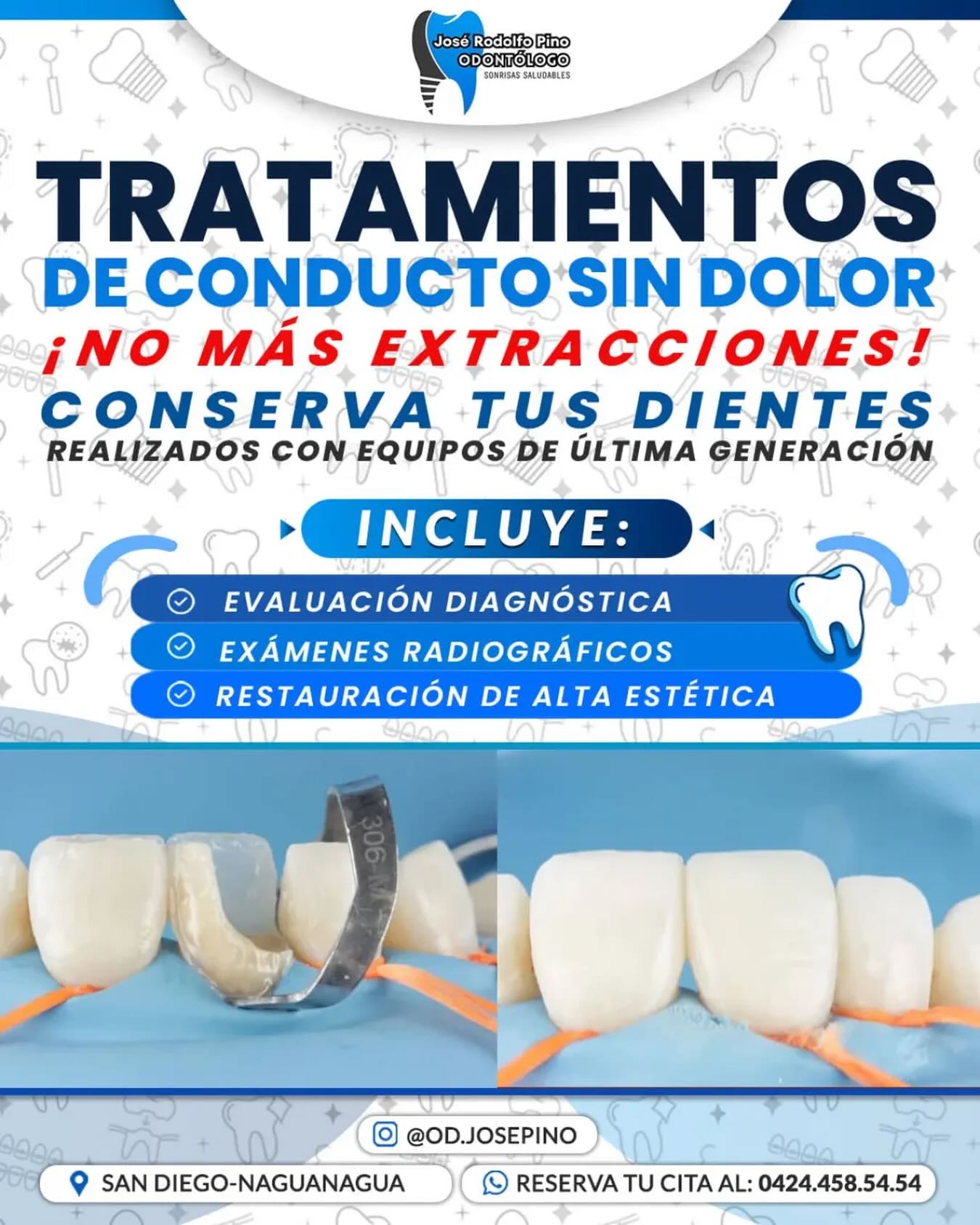 Od.josepino Facebook ad: ¿Sientes dolor en un diente?