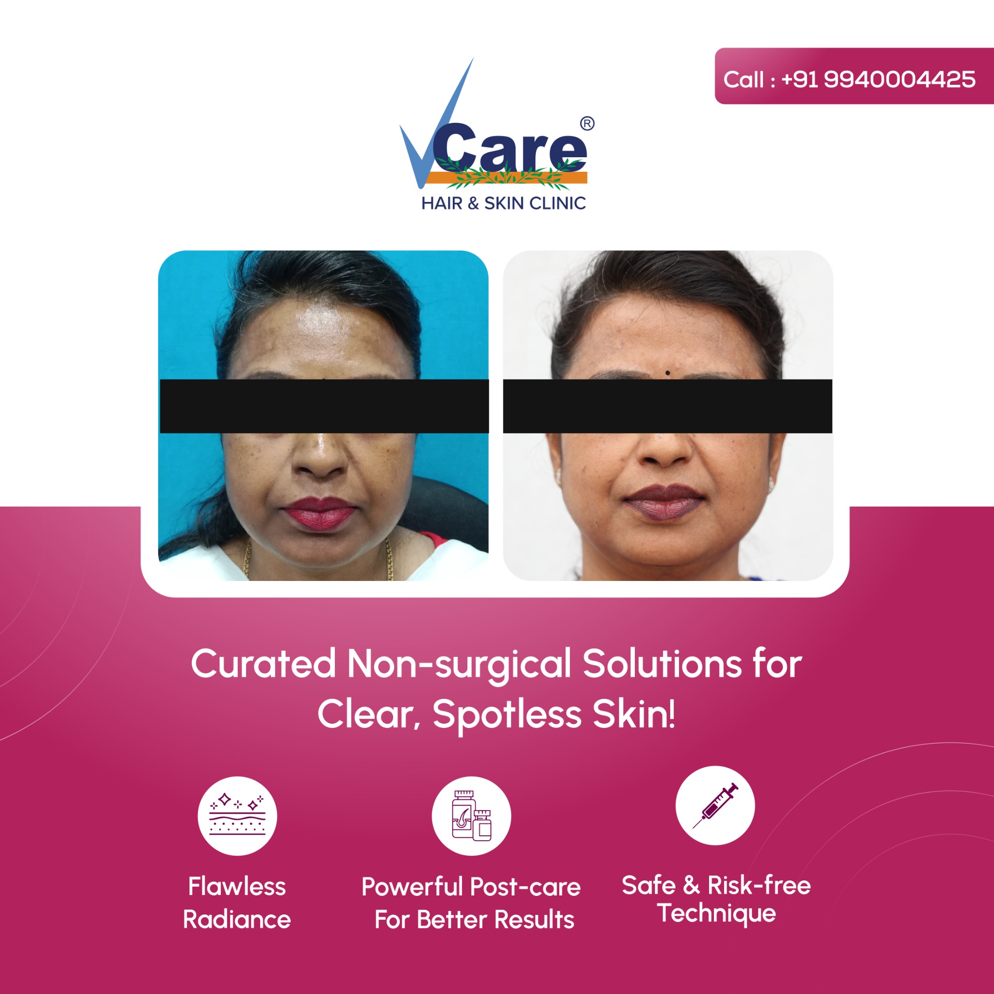 VCare Facebook ad