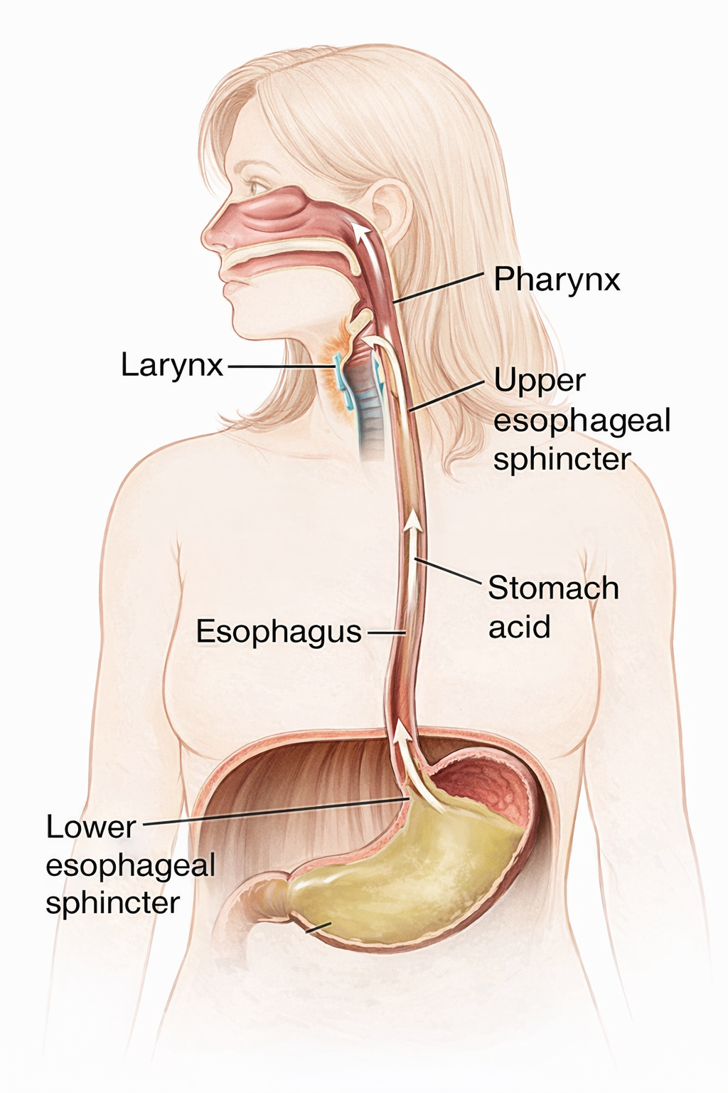 My Esophagus and Me Facebook ad