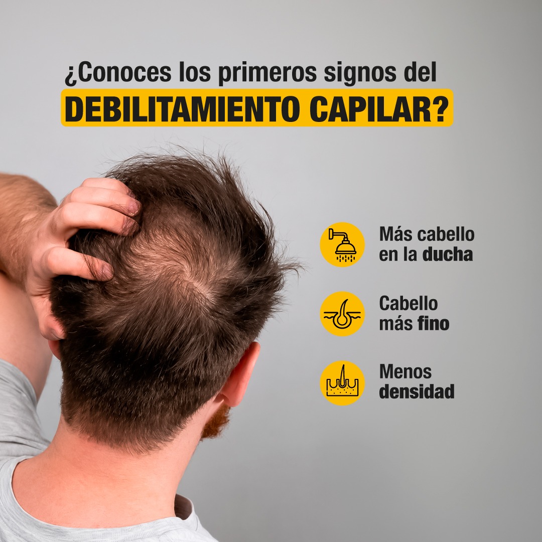 Alpecin Facebook ad: La caída del cabello no suele empezar de…