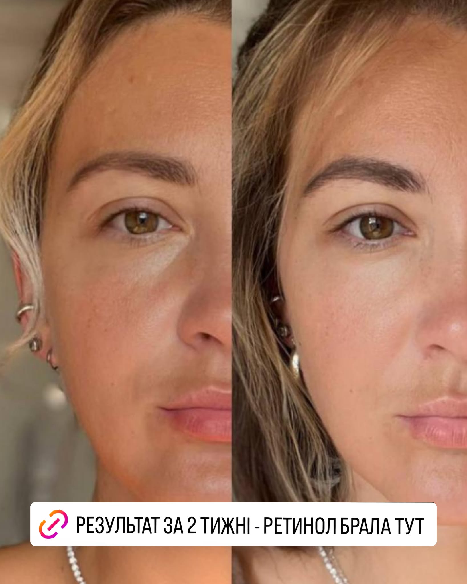 Robeauty Facebook ad
