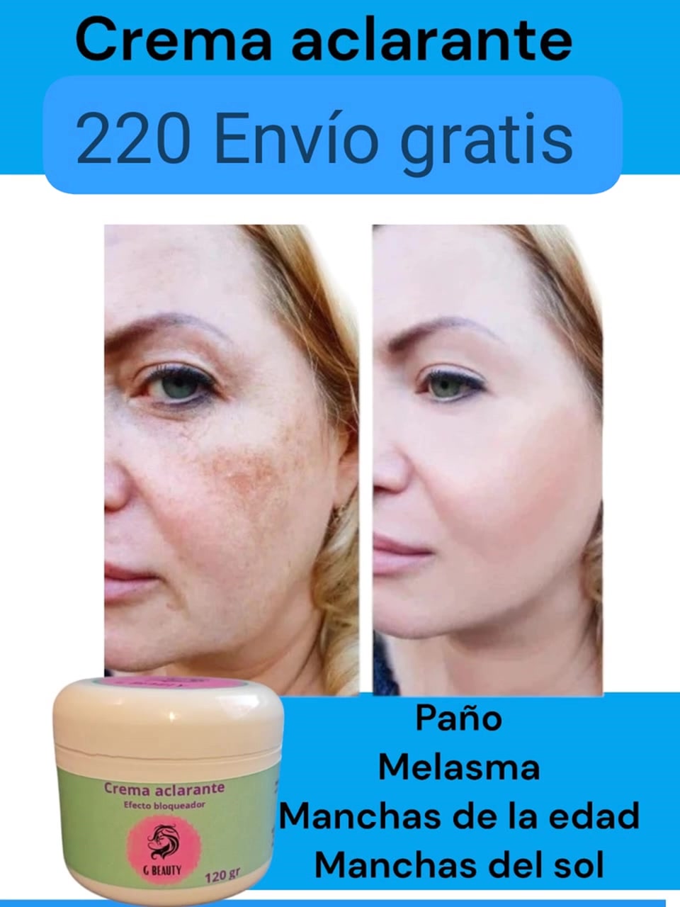 Marketplace Gadgets Facebook ad: ¿Manchas por sol o edad? En Guadalajara ya hay solución…