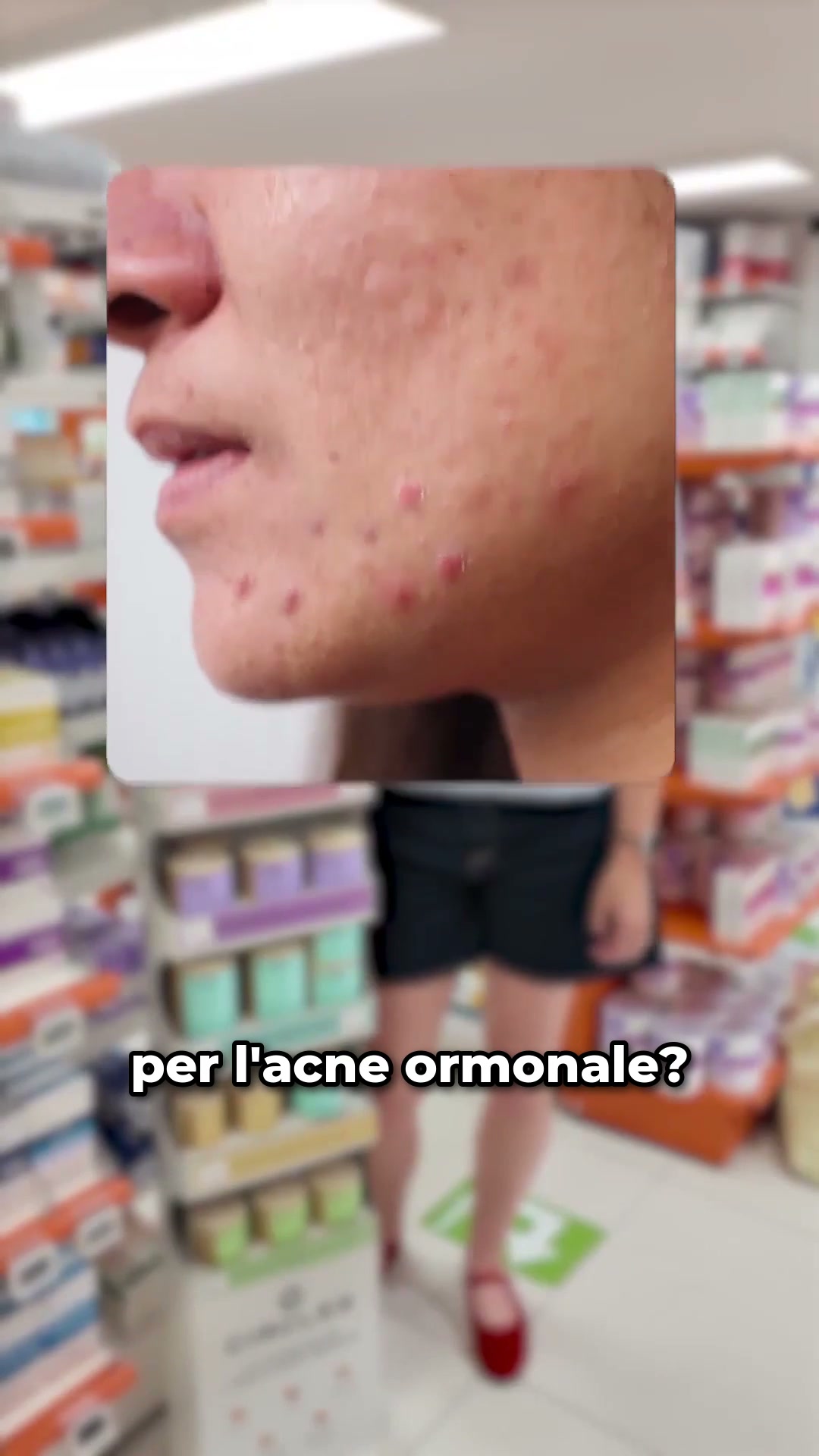 Circles Italia Facebook ad: Se le imperfezioni tornano col ciclo