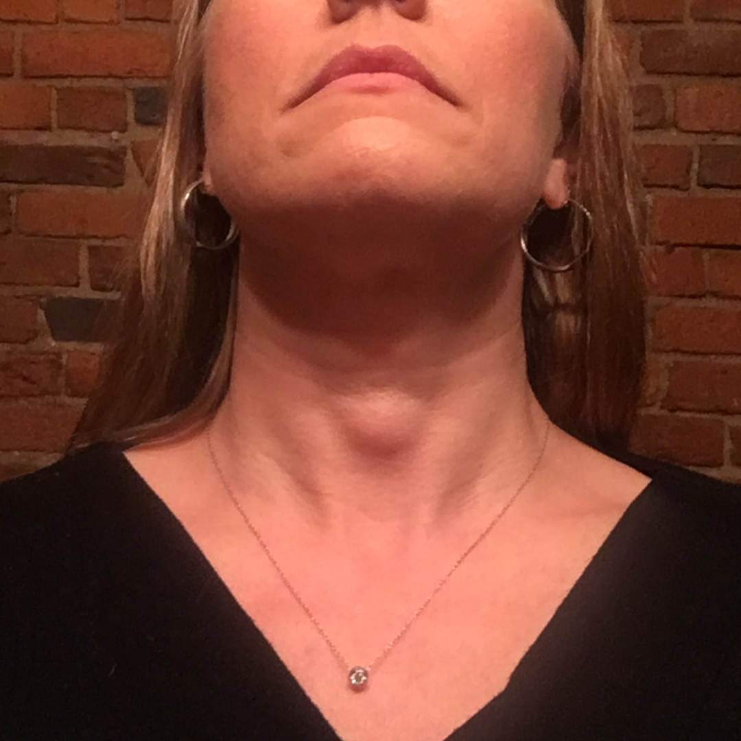 Dr. Kandace Kichler Facebook ad