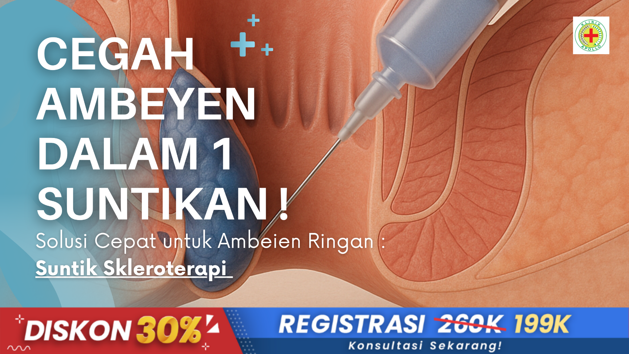 Klinik Wasir Apollo Facebook ad from Sep 12, 2025