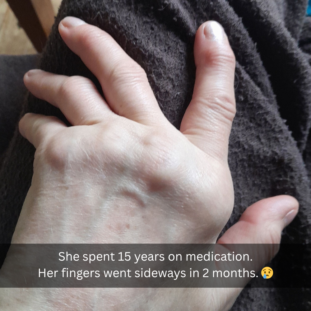 The Menopause Journal Facebook ad: Menopause did this to her hands