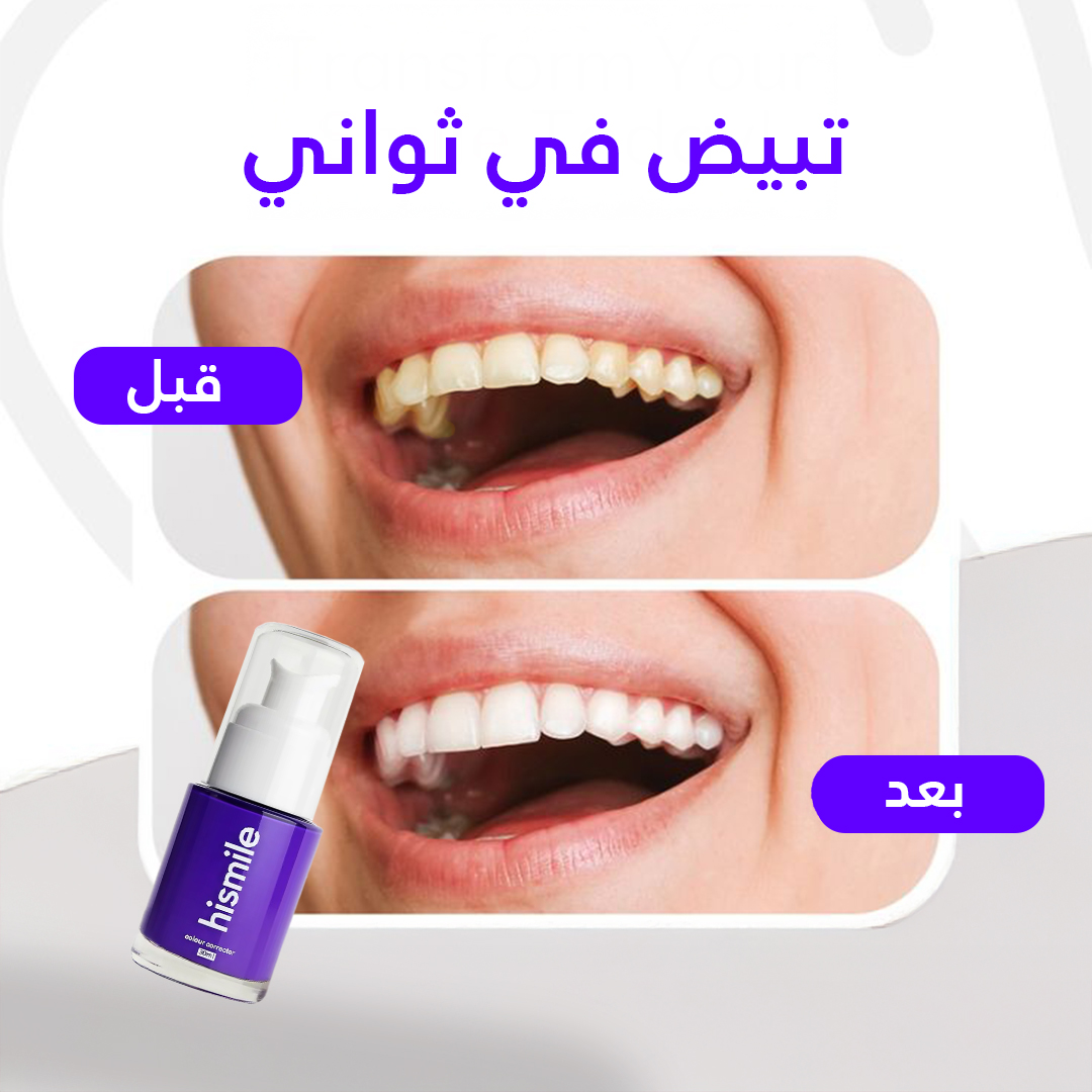 Hismile Facebook ad