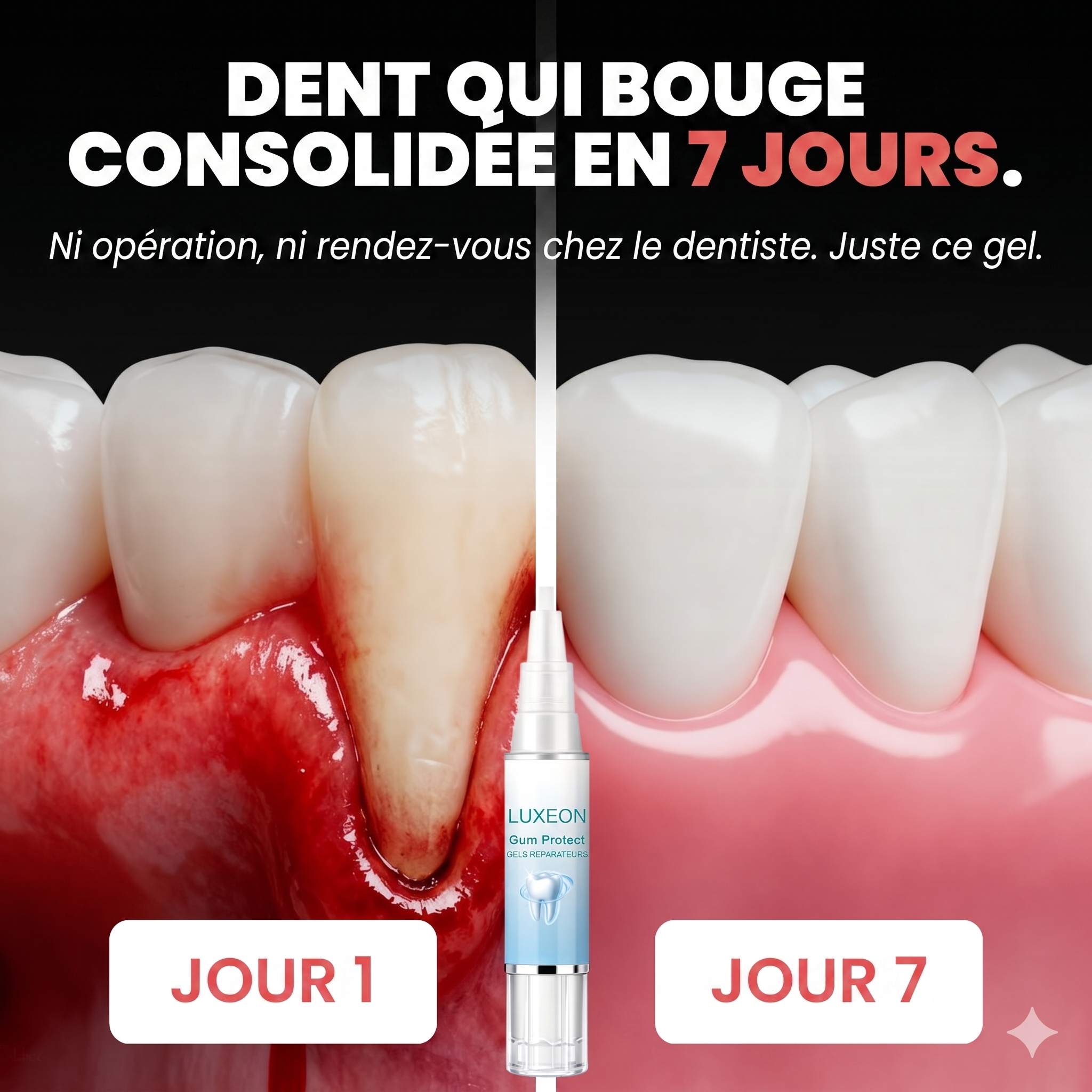 Luxeon OFF Facebook ad: Comment mes gencives ont commencé à repousser en quelques…