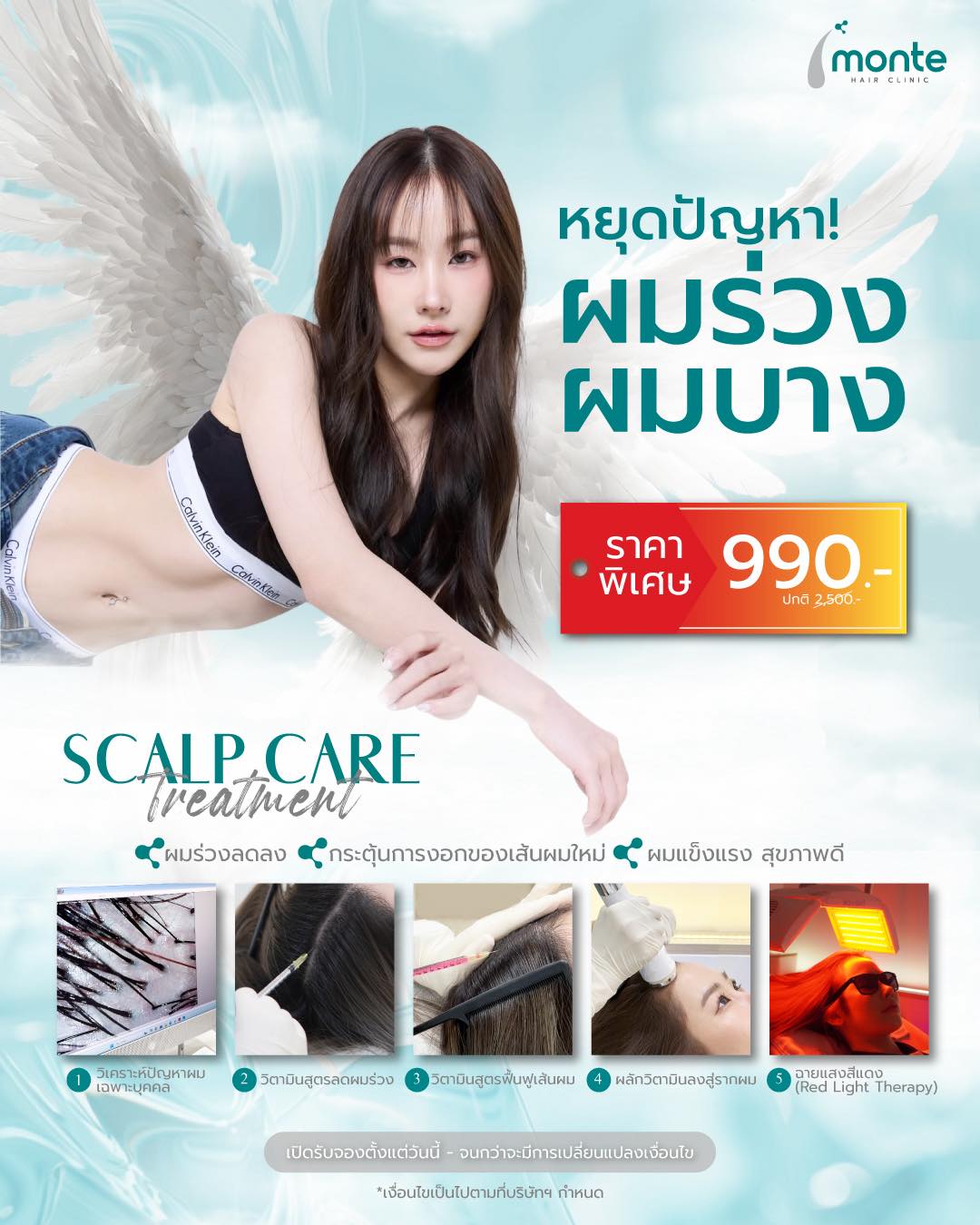 Monte Clinic - Hair Transplant ปลูกผมถาวร คิ้ว หนวดเครา รักษาผมบาง Facebook ad