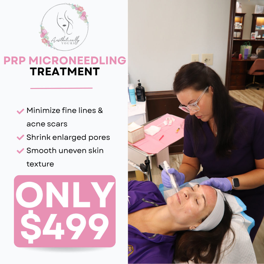 Aesthetically Yours Facebook ad: $499 PRP Microneedling Treatment!