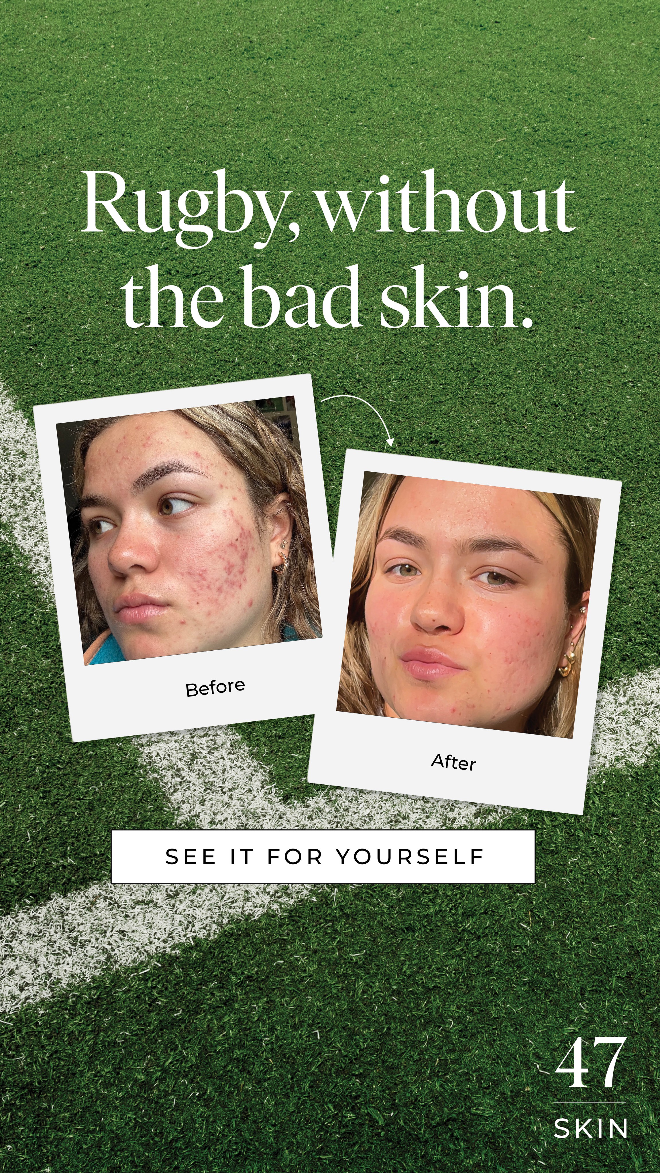 47Skin Facebook ad