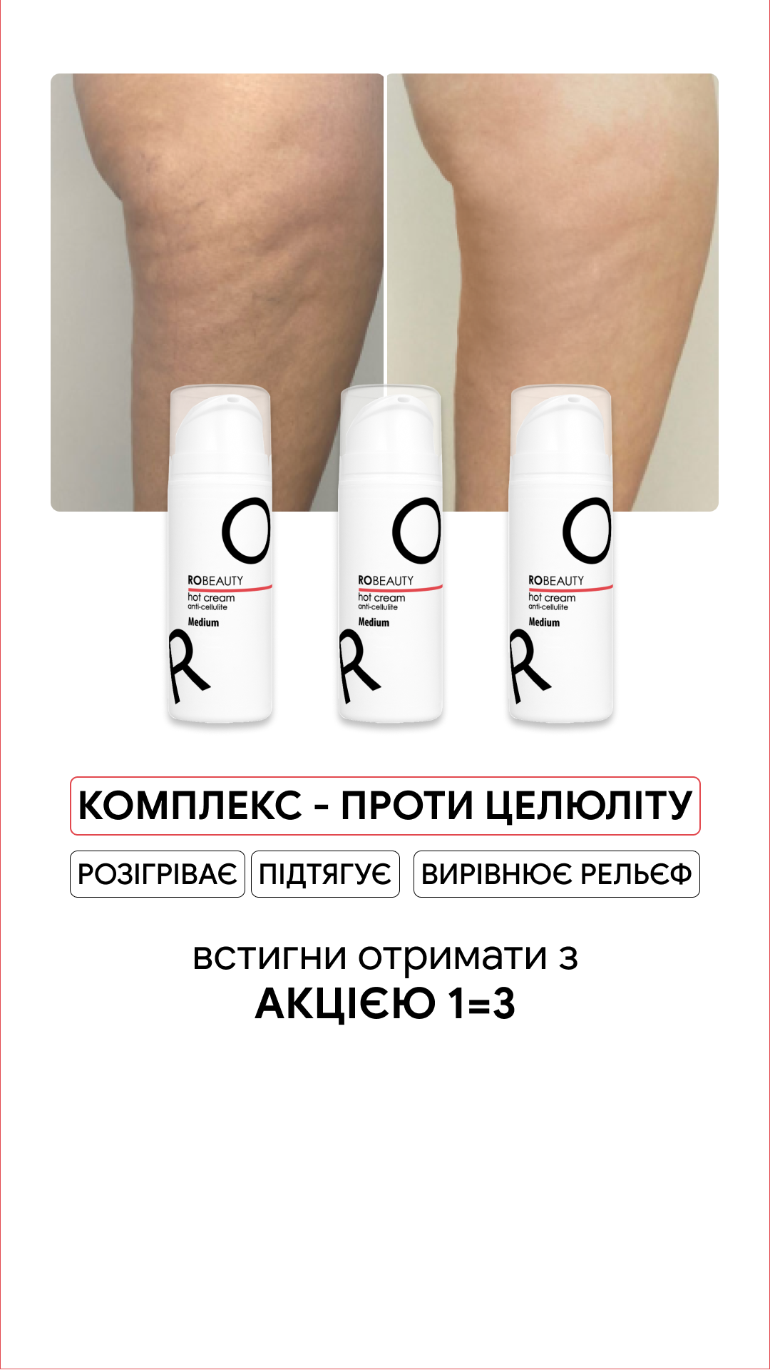 Robeauty Facebook ad