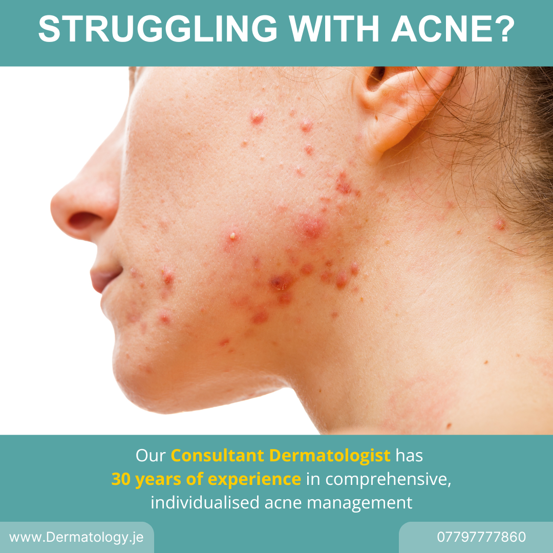 Advanced Dermatology Clinic Jersey Facebook ad
