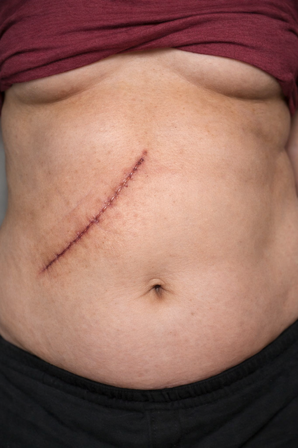 Claire Anderson Facebook ad: Fatty Liver? Read This First