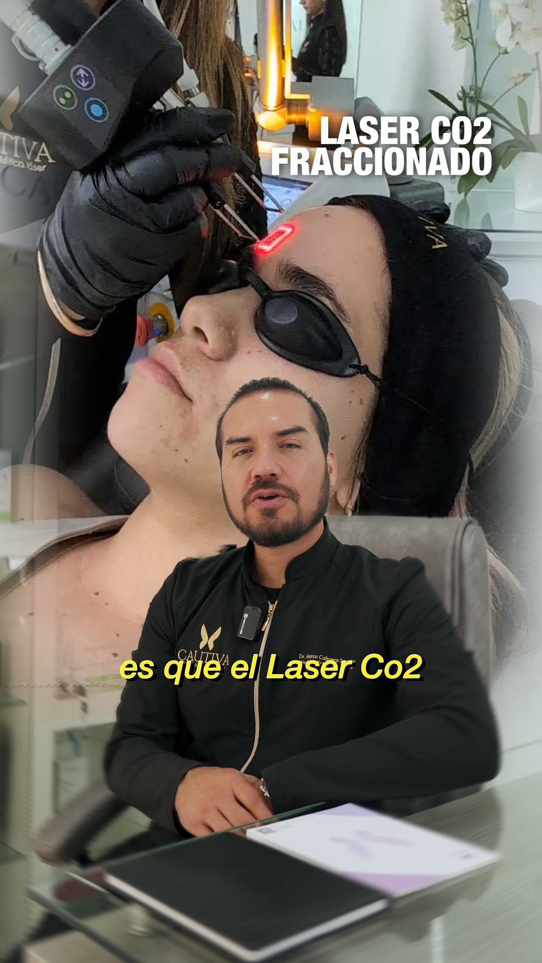 Cautiva Láser CM Facebook ad: Tratamiento Laser Co2 fraccionado