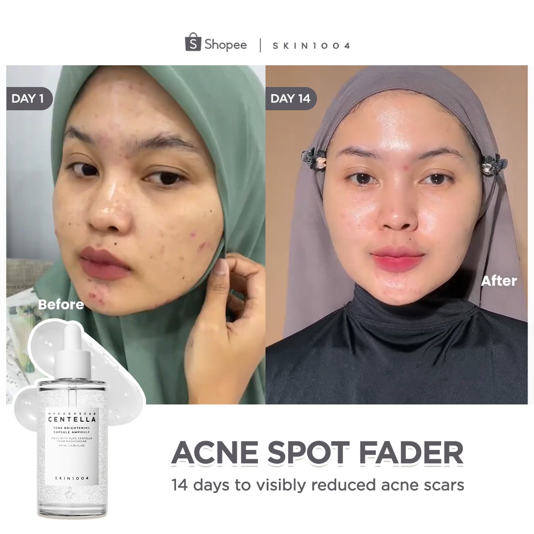 SKIN1004_Indonesia Facebook ad