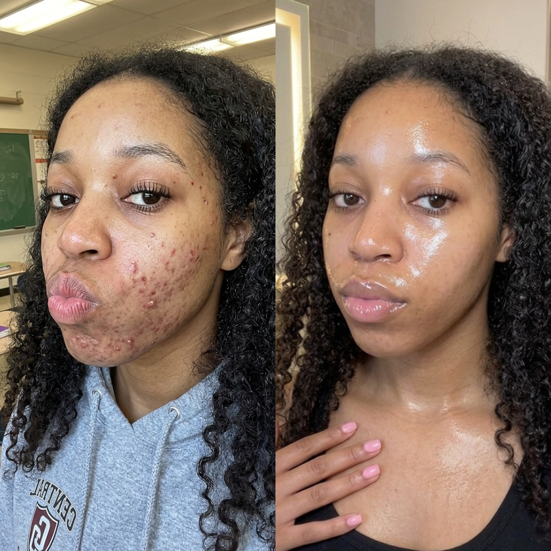 Keisha's Skin Care Journey Facebook ad