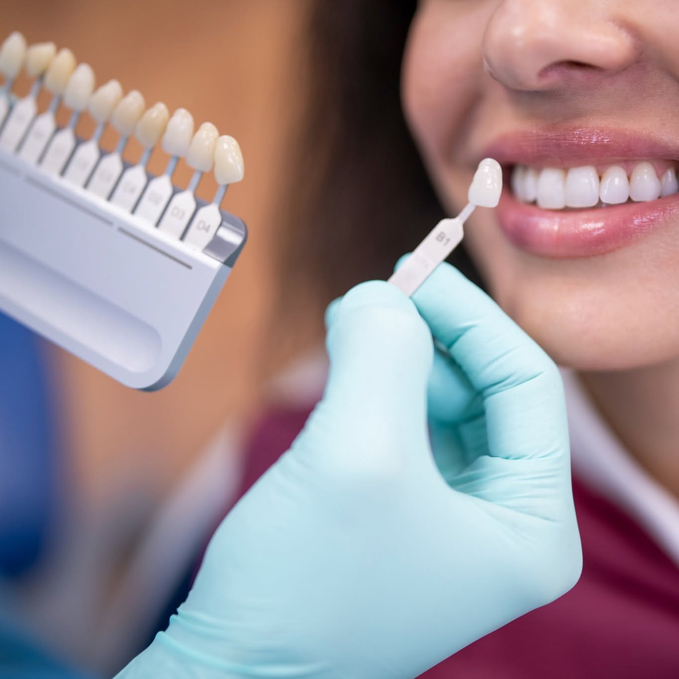 Collaroy Dental Facebook ad: Rapid Results with In-Chair Teeth Whitening