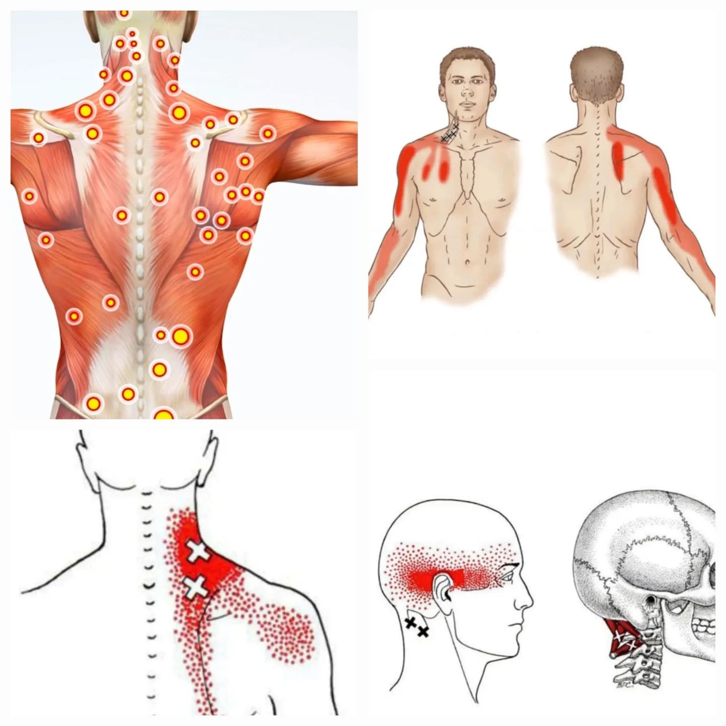 Osteopathy Nasiopoulos Facebook ad