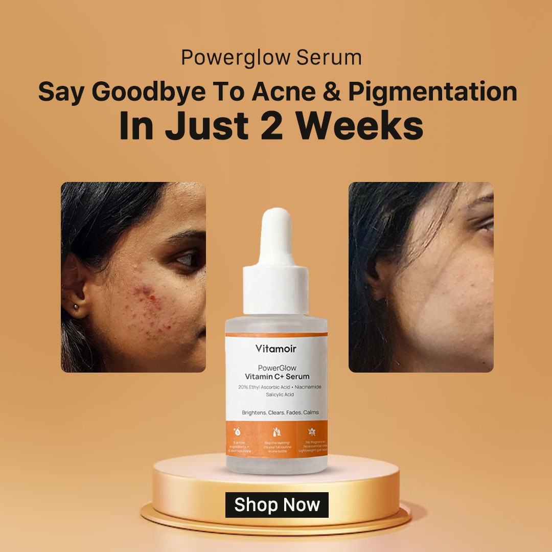 Vitamoir Facebook ad: Fades Dark Spots In 2 Weeks