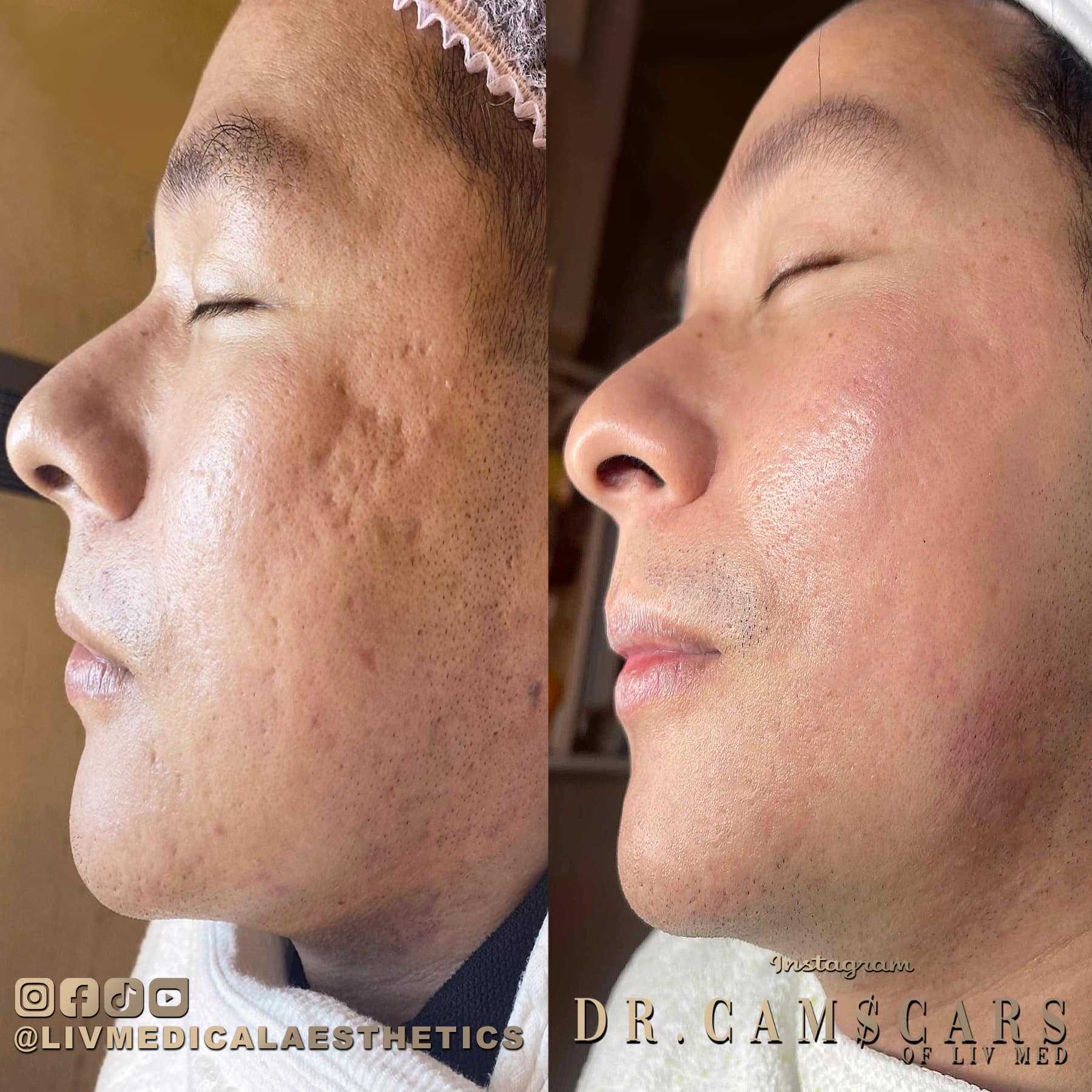 Liv Medical Aesthetics and Wellness Center Facebook ad