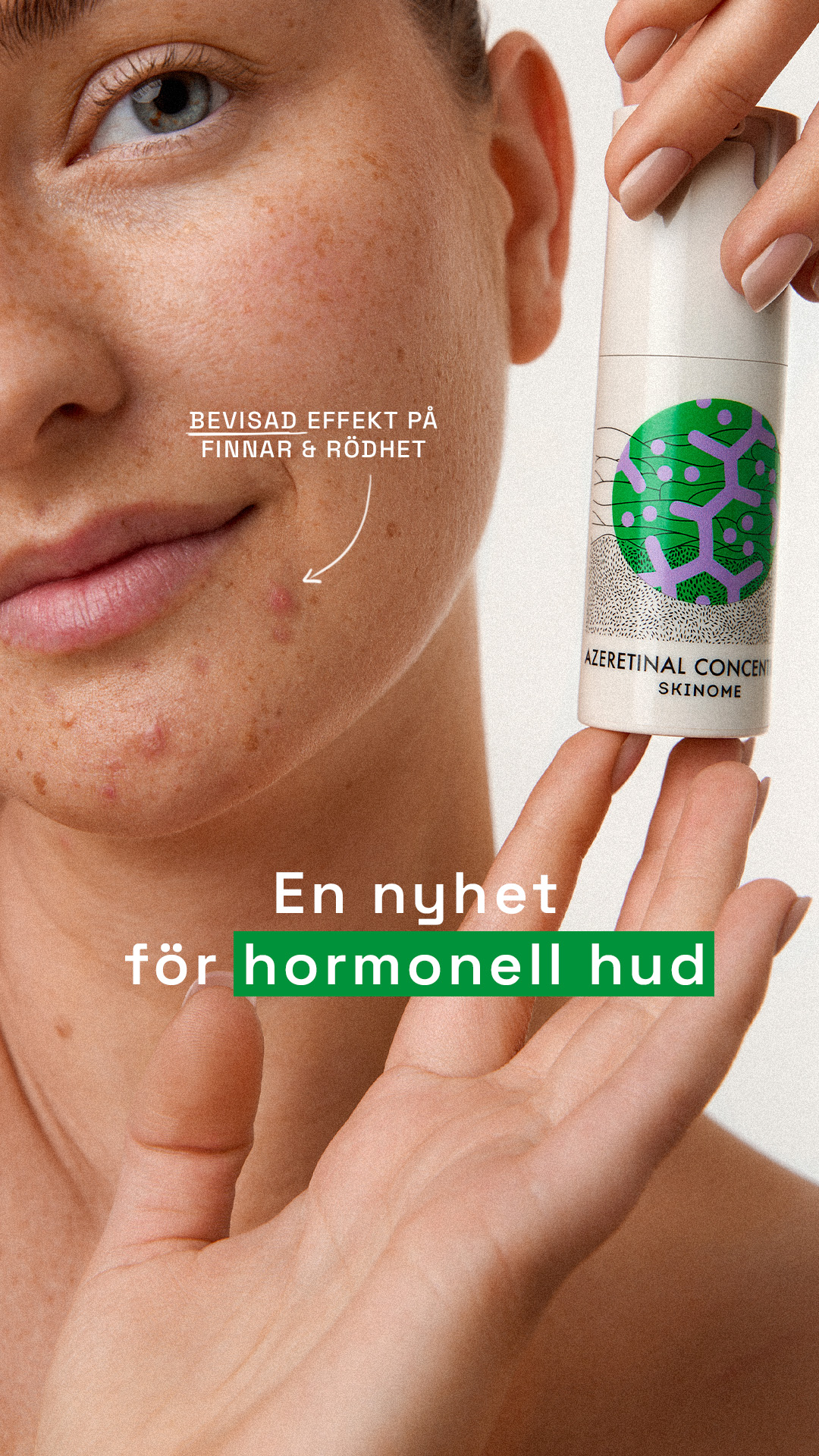 Skinome Facebook ad