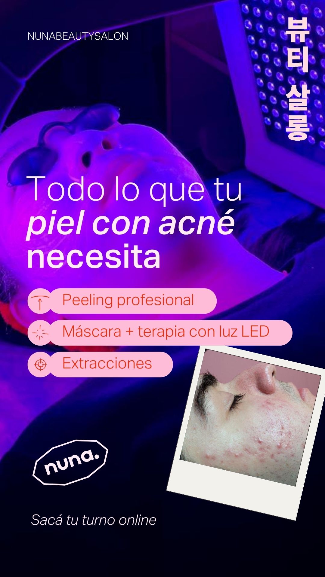 Korean Makeup Buenos Aires Facebook ad: ¿PIEL CON ACNÉ?