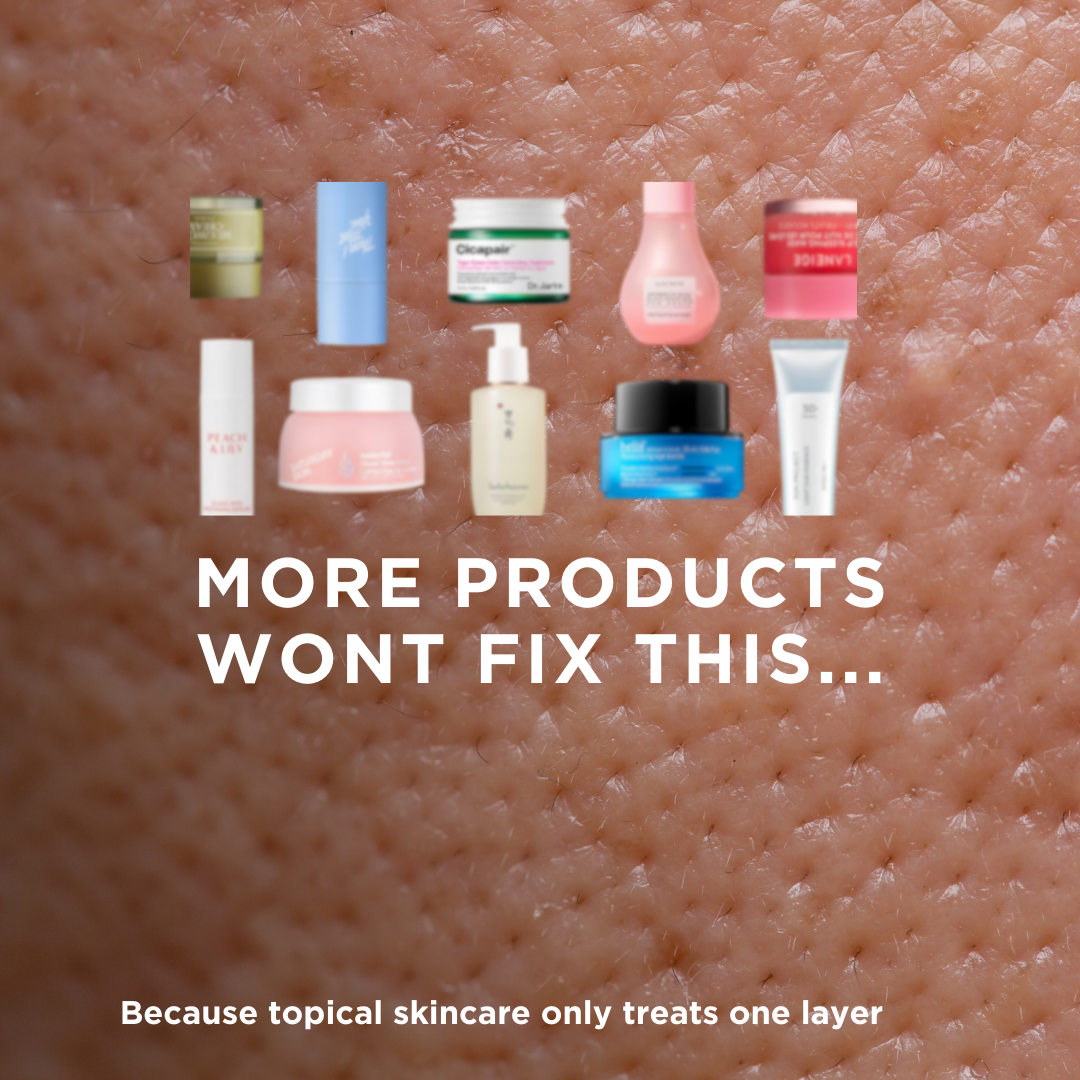 SkinB5 Facebook ad