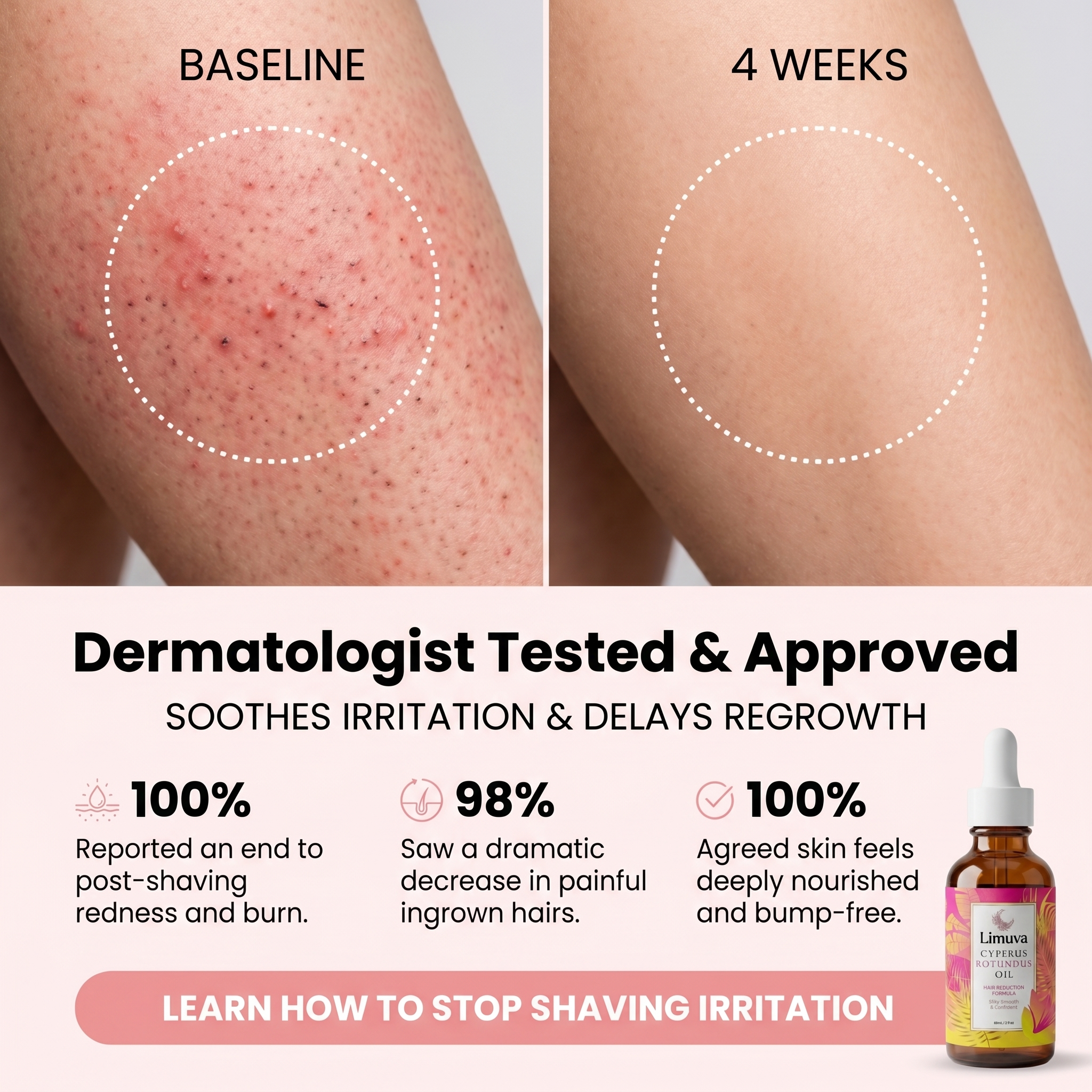 Kendra Lewis Facebook ad: Say Goodbye To Razor Bumps