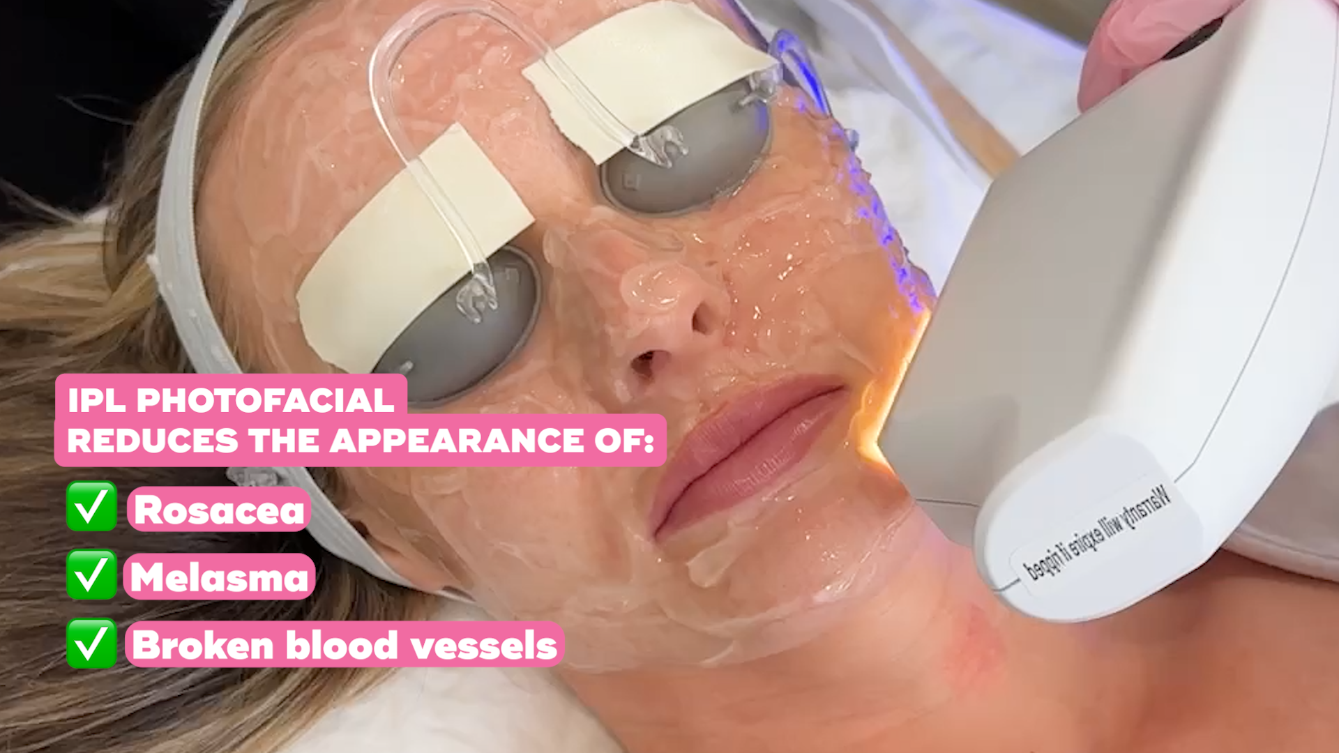 LaserAway Facebook ad