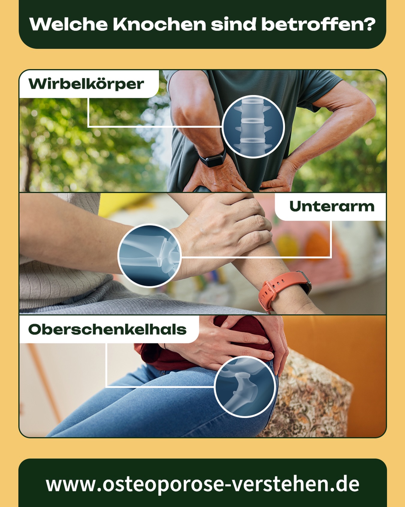 Deutscher Orthopäden- und Unfallchirurgen-Verband e.V. Facebook ad: Osteoporose verstehen