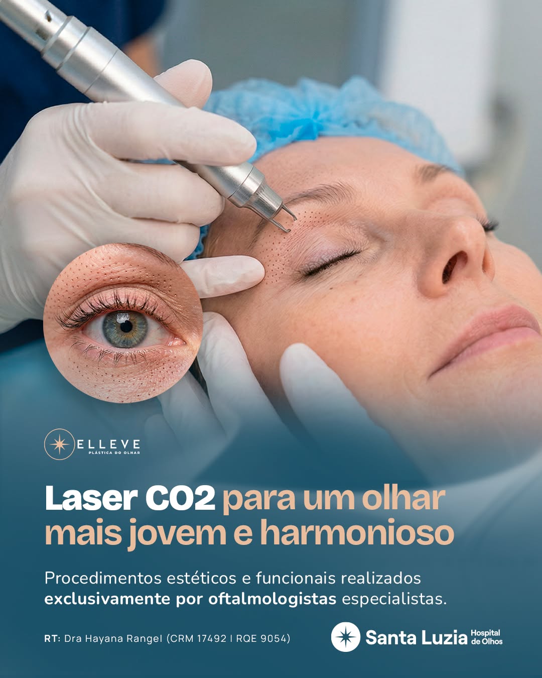 Hospital de Olhos Santa Luzia Facebook ad from Jul 3, 2026