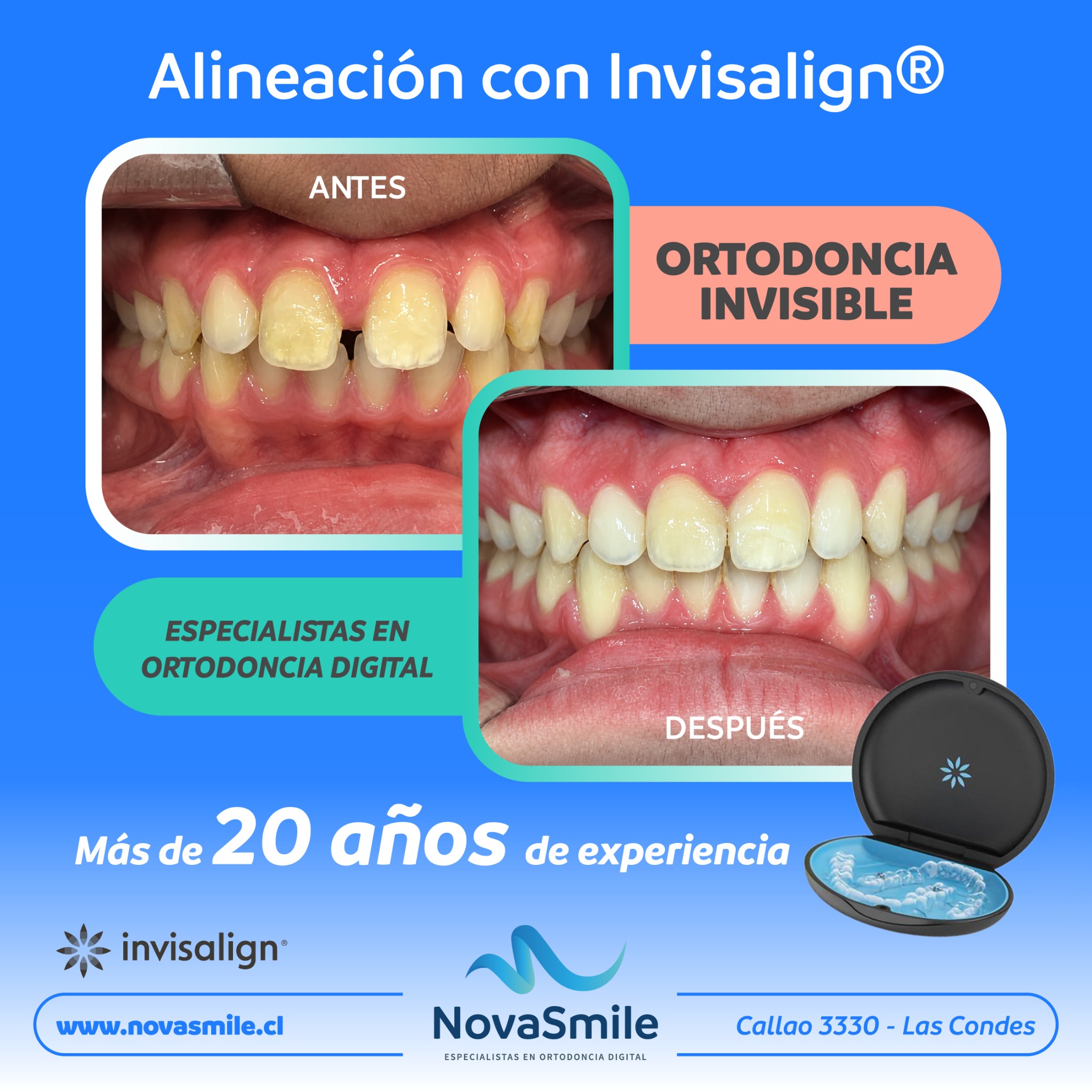 NovaSmile Facebook ad from Jul 2, 2026