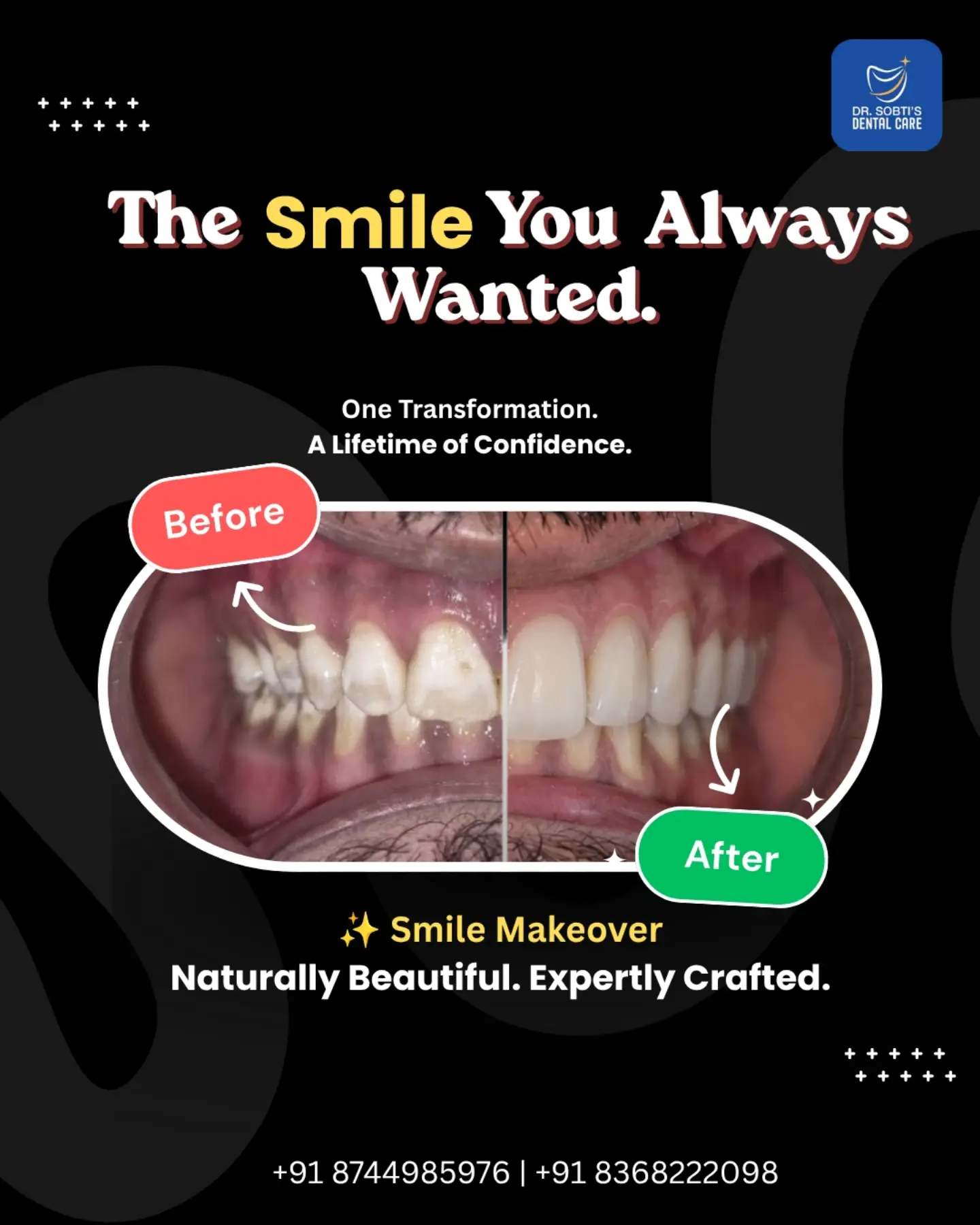 Dr Sobti's Dental Care Facebook ad: A confident smile can change everything.