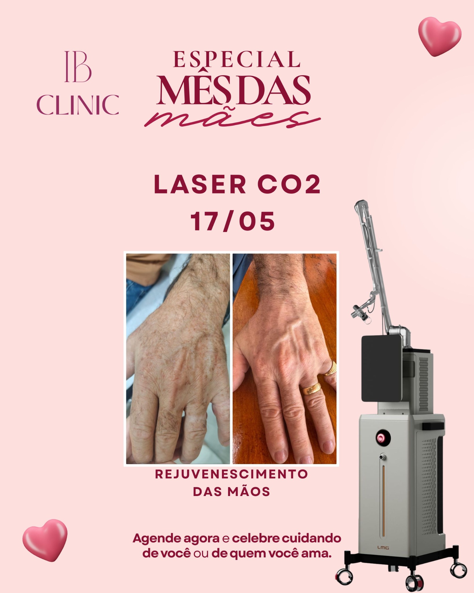 IB Clinic Boulevard Mogi Guaçu Facebook ad: Converse conosco