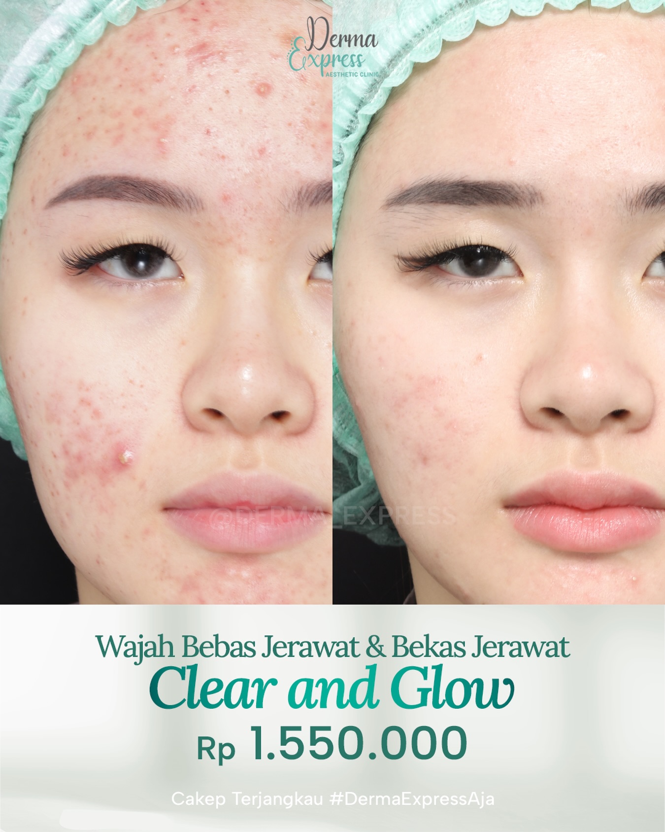derma_express Facebook ad