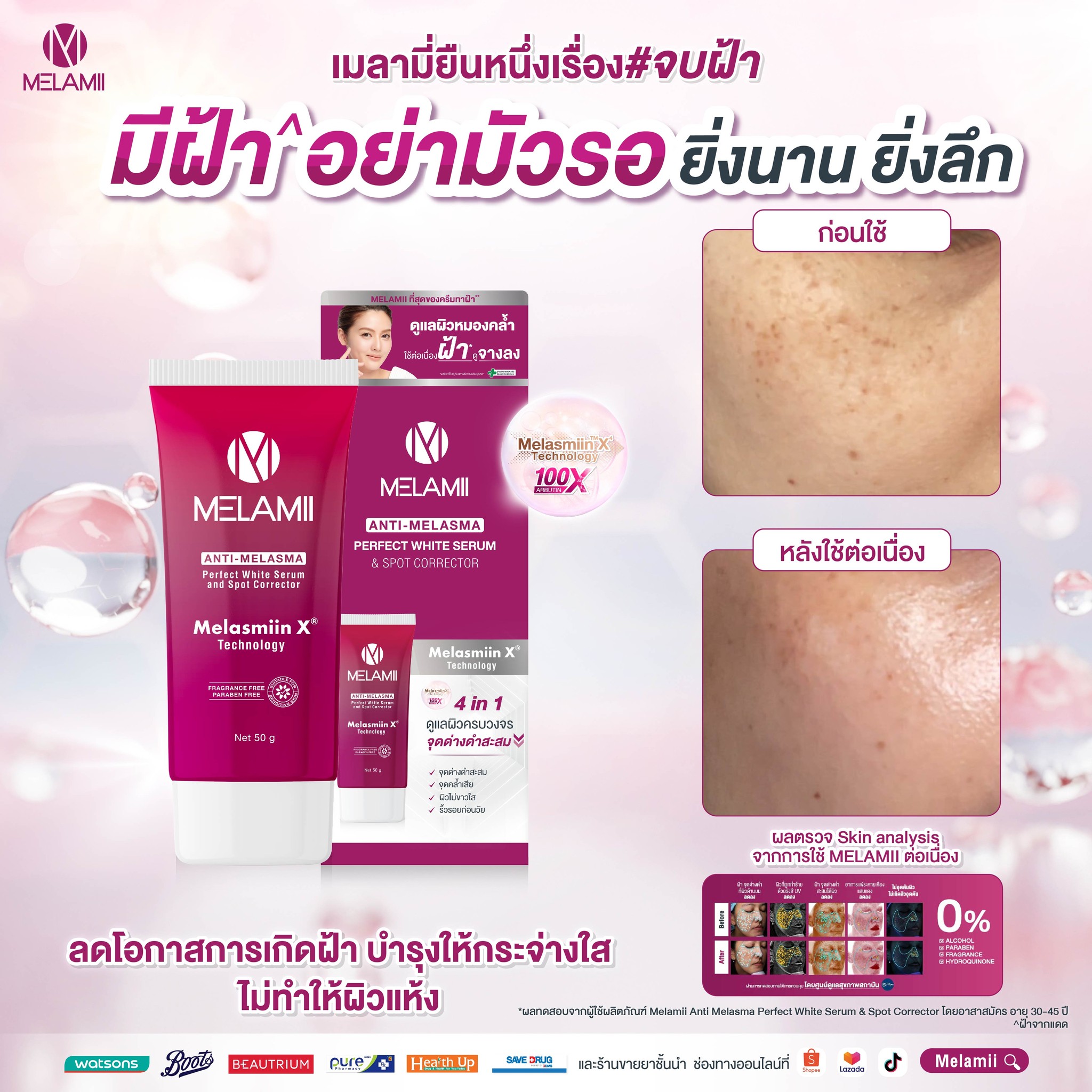 Melamii Anti Melasma Club Facebook ad