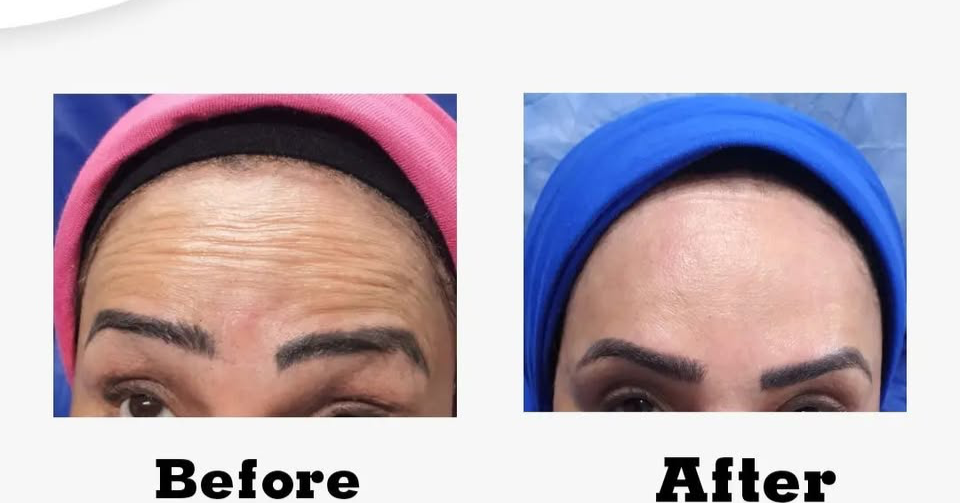 Magic skin clinics Facebook ad