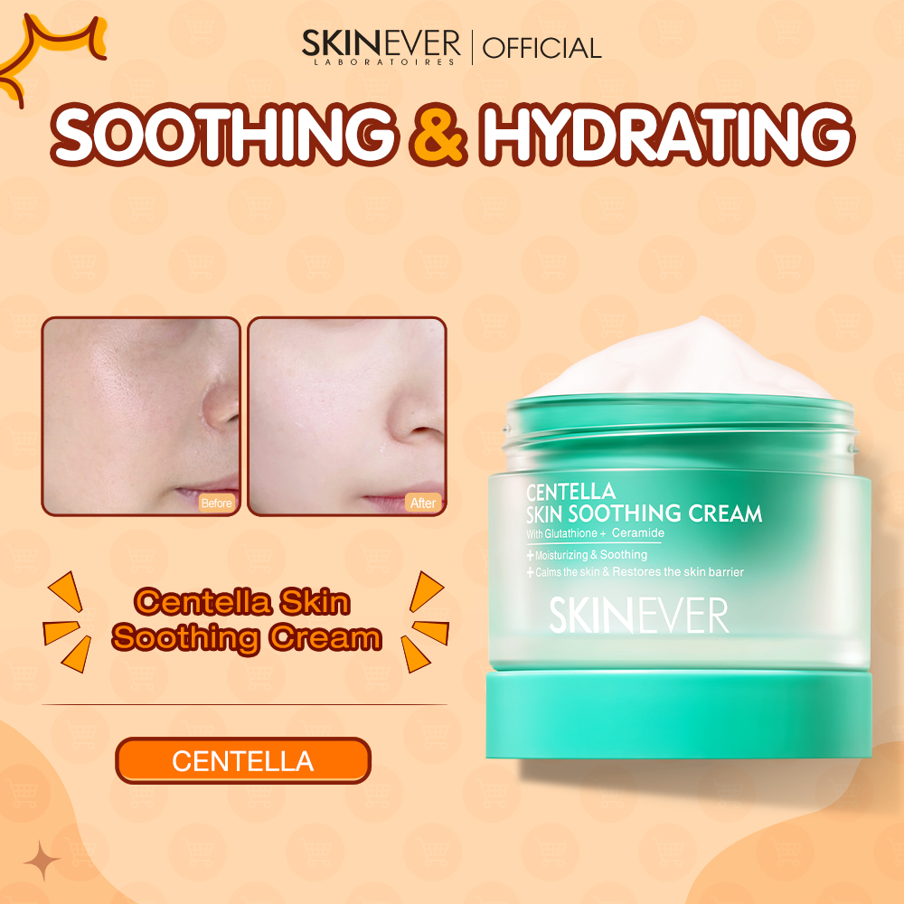 Skinever Facebook ad