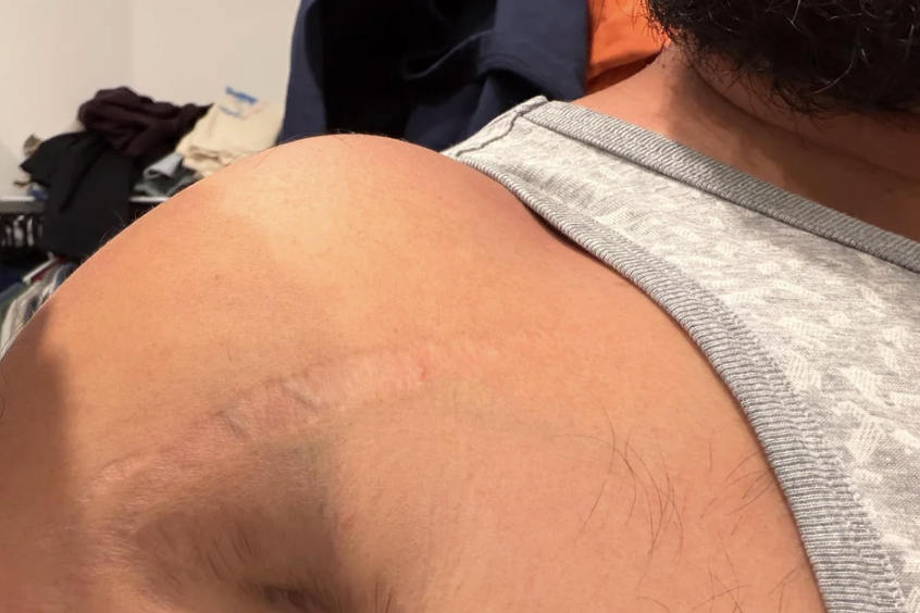 Dr. Abigail Morris Facebook ad: My Shoulder Hurt for 3 Years. 4 BPC-157 Brands Did…